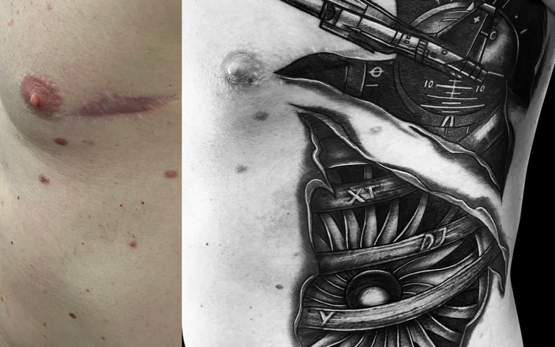 RECOUVREMENT CICATRICE