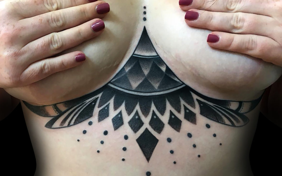 Underboobs cicatrice