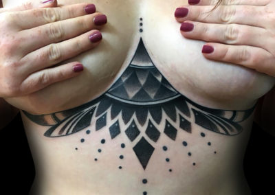 Underboobs cicatrice