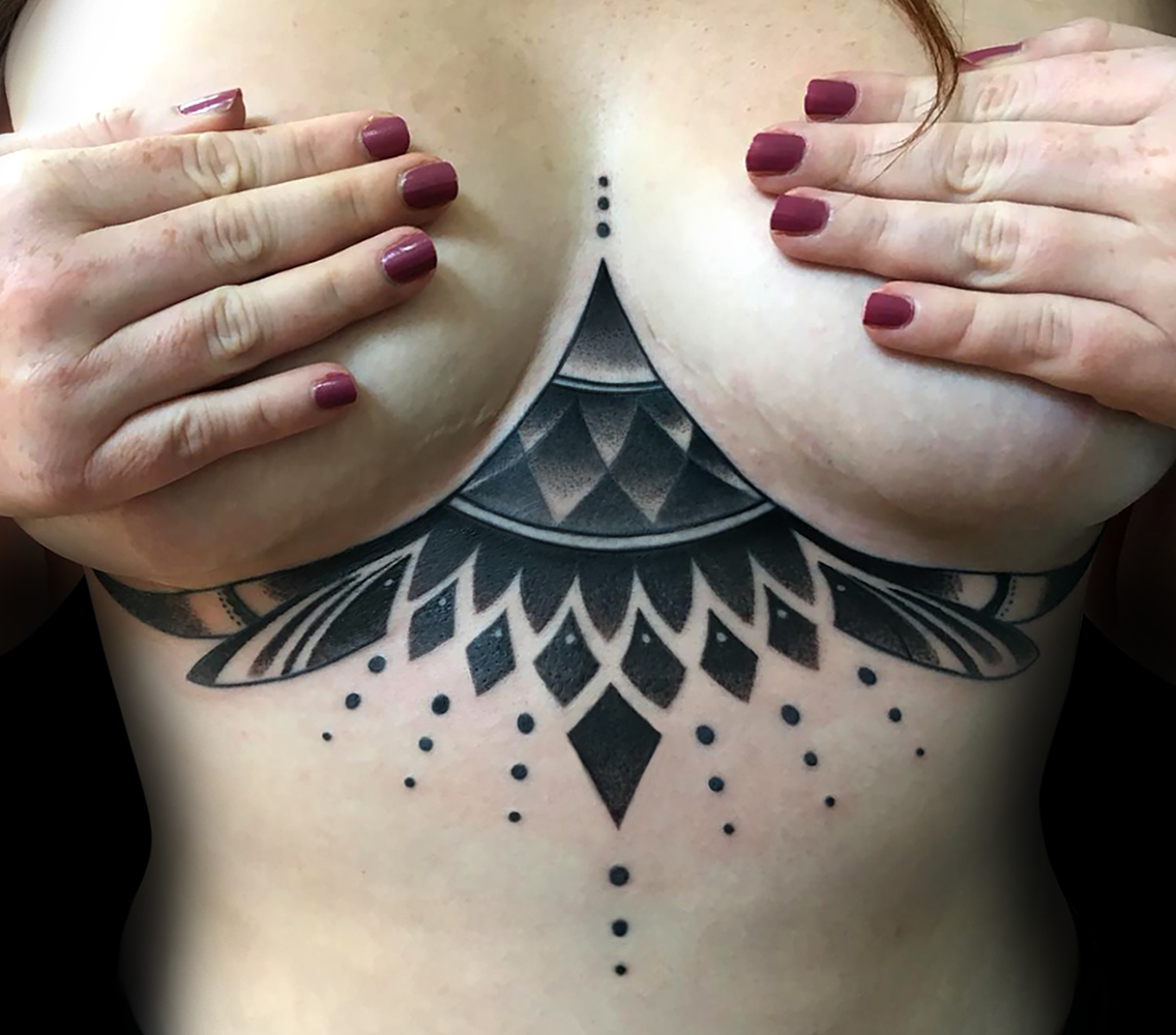 Recouvrement de cicatrices