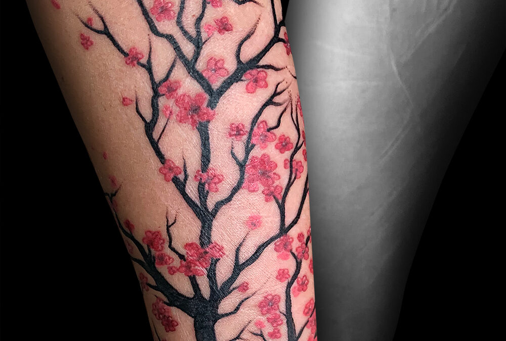 Recouvrement cicatrices