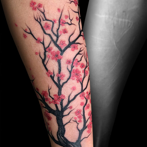 Recouvrement cicatrices