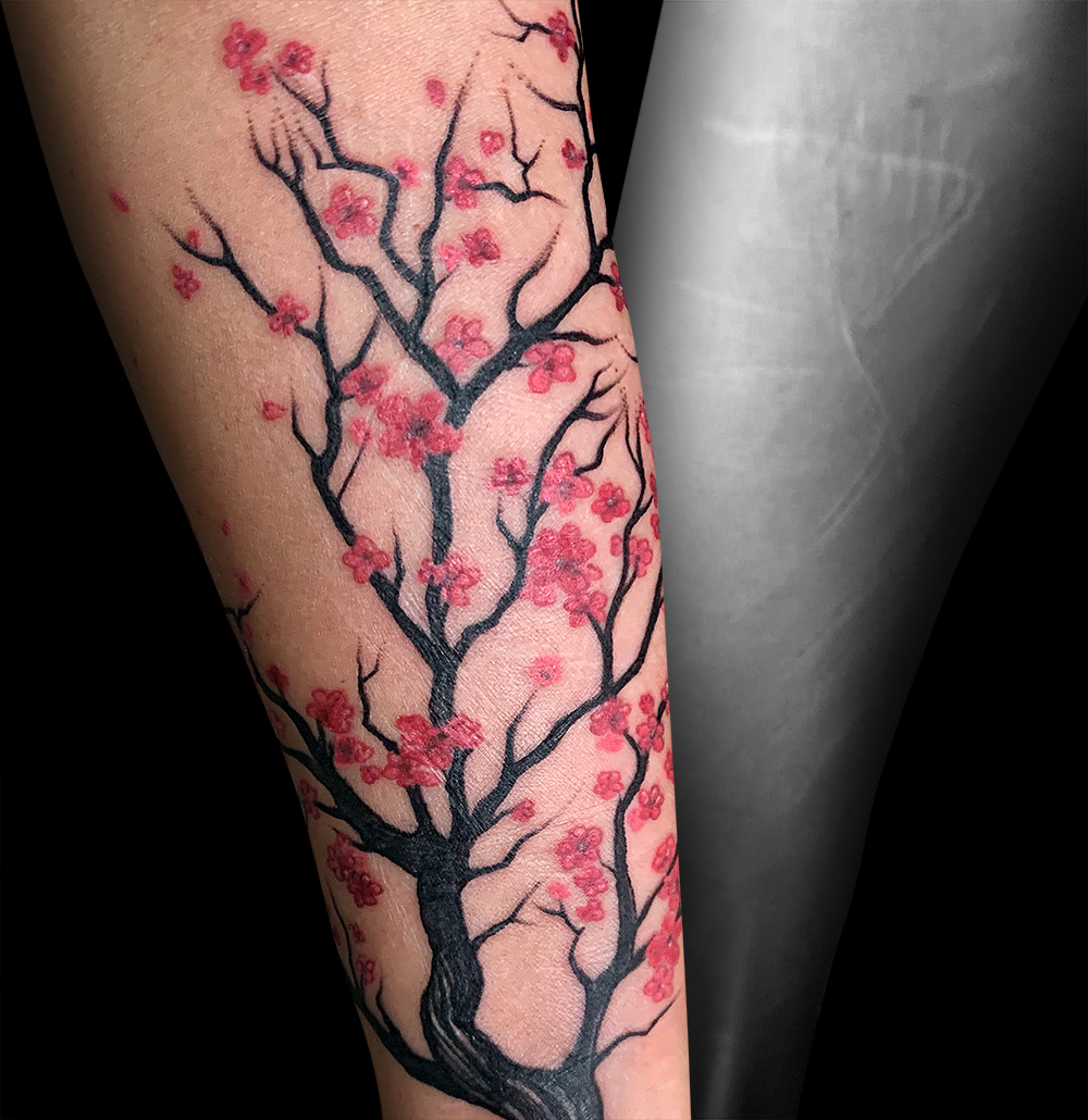 Recouvrement de cicatrices